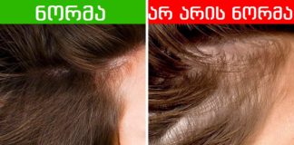 რას ამბობს თმის მდგომარეობა თქვენს ჯანმრთელობაზე
