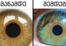 7 რამ, რასაც თქვენი თვალების ფერის შეცვლა შეუძლია