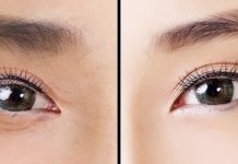 იაპონური ტექნიკა თვალის ირგვლივ კანის გასაახალგაზრდავებლად. მხოლოდ 1 წუთი დაგჭირდებათ