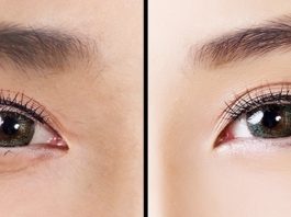 იაპონური ტექნიკა თვალის ირგვლივ კანის გასაახალგაზრდავებლად. მხოლოდ 1 წუთი დაგჭირდებათ