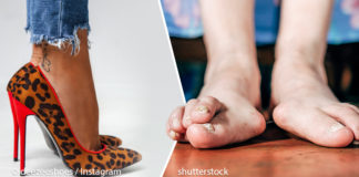 5 პოპულარული ქალის ფეხსაცმელი, რომლებიც სხეულს რეალურ ზიანს აყენებენ
